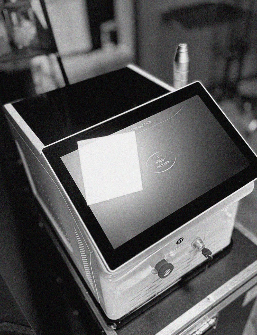 laserowe usuwanie tatuaży - tattoo station